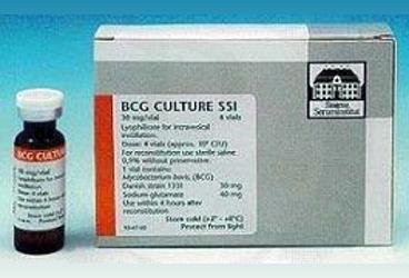 BCG SSI KULTURU